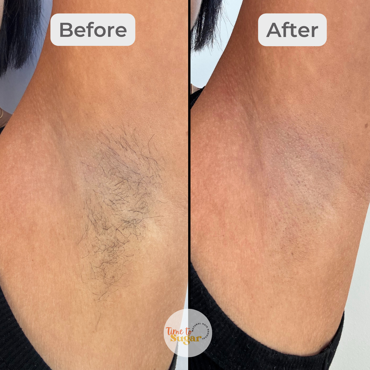 Duo Sugaring Kit | Firm + Soft Paste (26oz) with Strips & Accessories